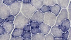 Muscle cells