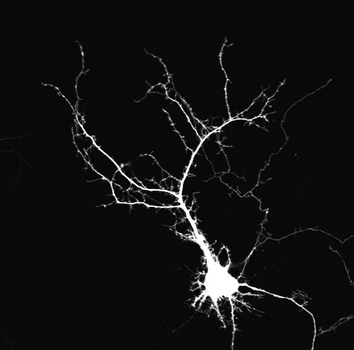 Dendrite Tree