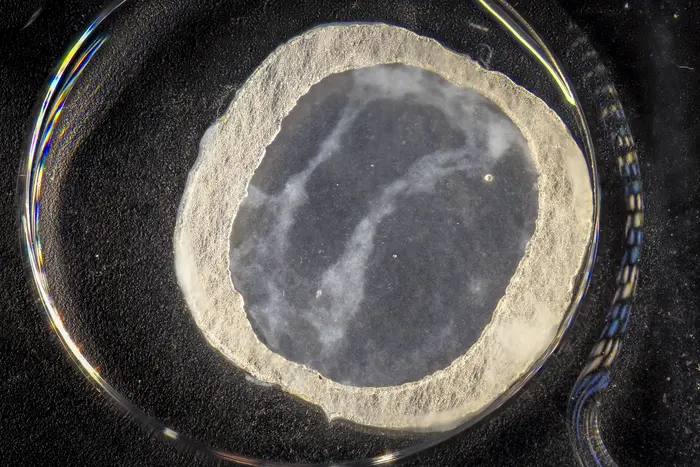 Closeup of a heart patch