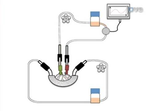 Tissue Engineering of a Human 3-D in vitro Tumor Test System