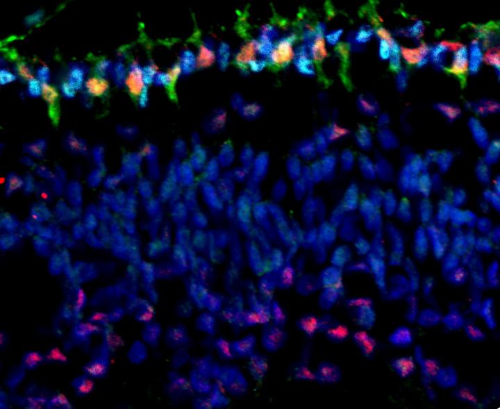 Microscopic Image of the Retina