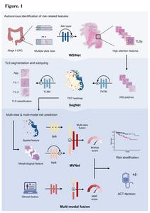 Deep learning model trained with stage II colorectal cancer whole slide images identifies features associated with risk of recurrence – with higher success rate than clinical prognostic parameters