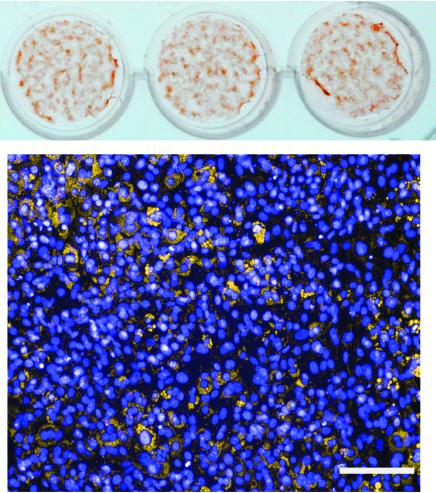 Finding the Kinases That Power Brown Fat