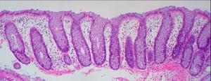 Colonic biopsy samples