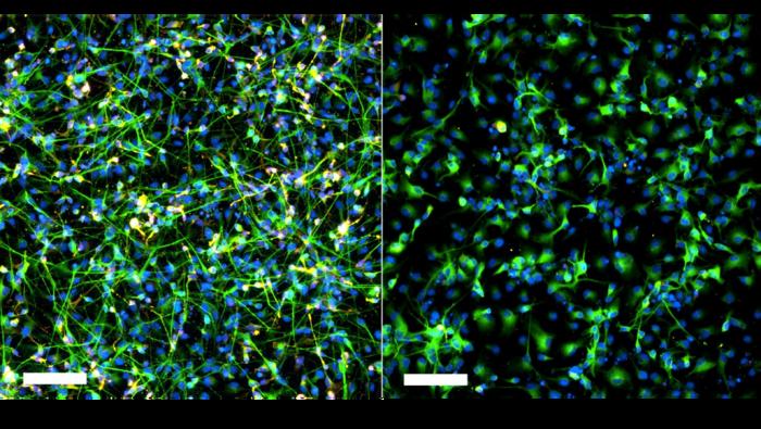 Adding inflammation molecule TNF-α to hippocampal stem cells results in few cells developing into neurons.