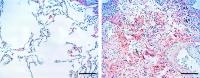 Lumican In Lungs