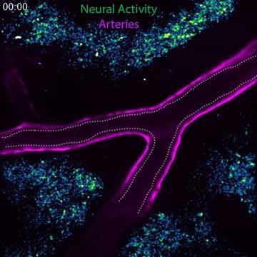 Neurovascular Coupling in Action