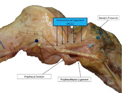 New Ligament Discovered in Human Knee