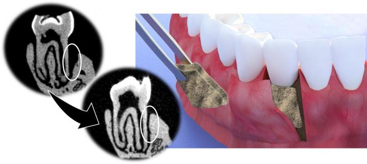 Periodontal Membrane