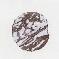 The KRT7 Gene