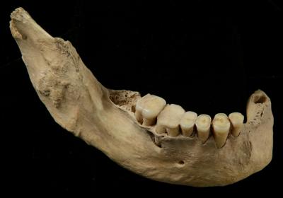 Mandible