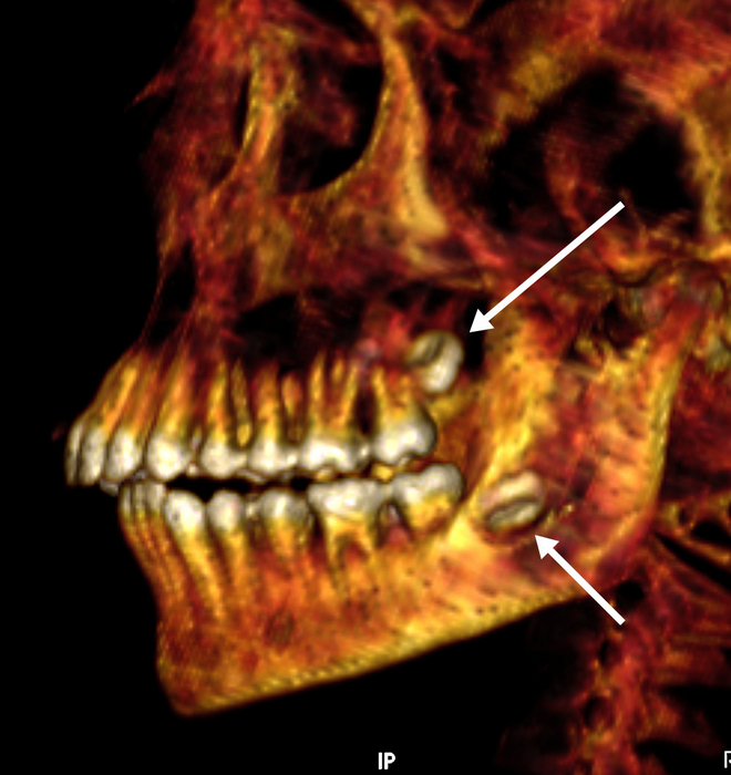 Teeth