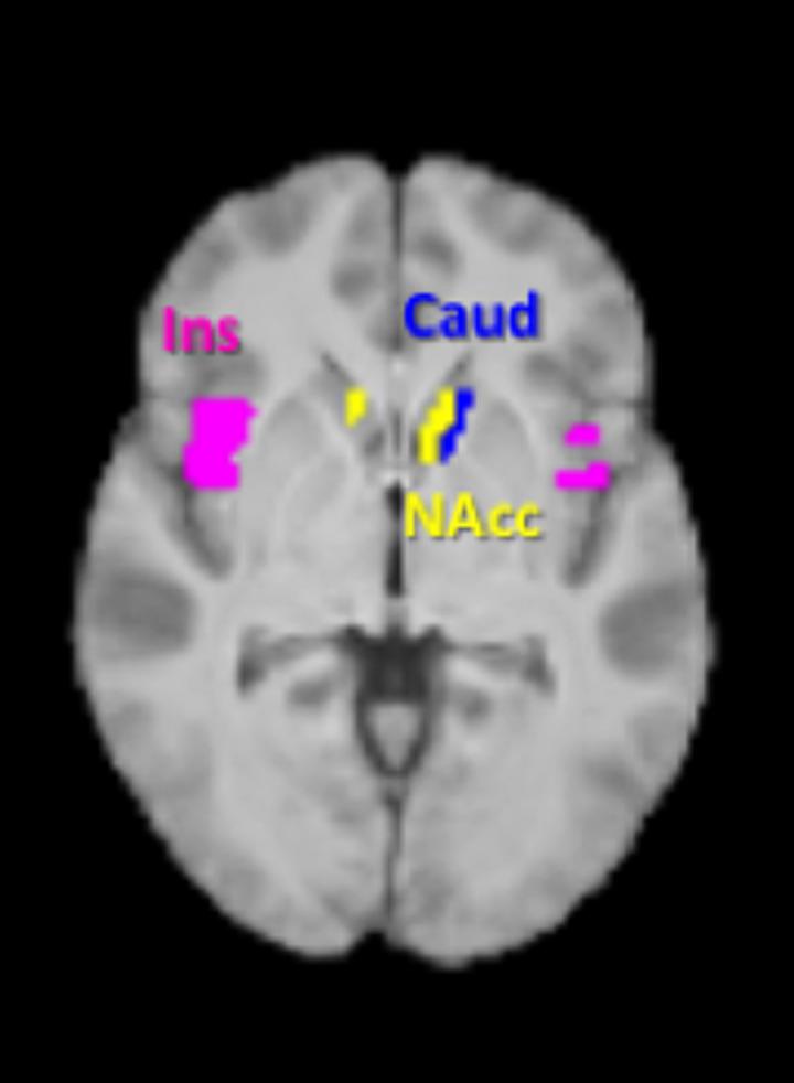 Brain Areas Responsible for Food Cravings
