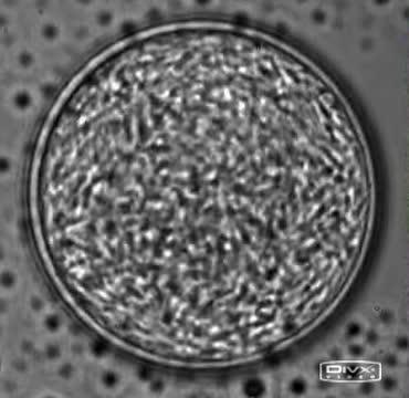 Bacterial Vortex Experiment