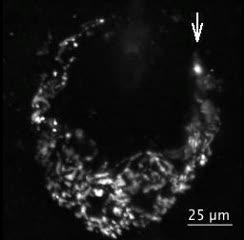 Sense of Touch Requires Mysterious Merkel Cells (1 of 5)