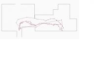 Walking Pattern of ALF Resident Experiencing Cognitive Decline vs. Control Subject