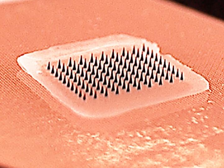 Microneedles
