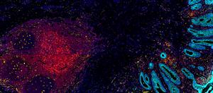 Spatial omics image