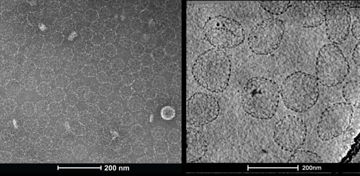 AI-designed protein nanocages observed by electron microscopy