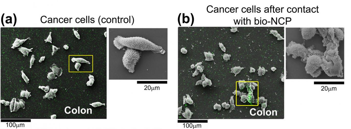 Cancer Cells