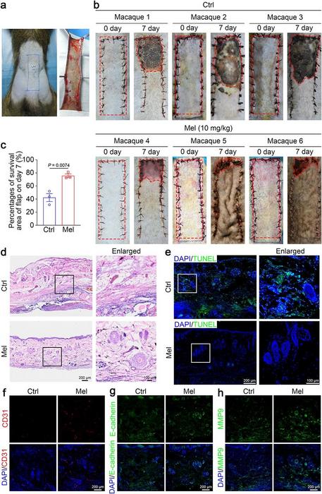 Melatonin promotes the survival of random skin flaps in macaques.
