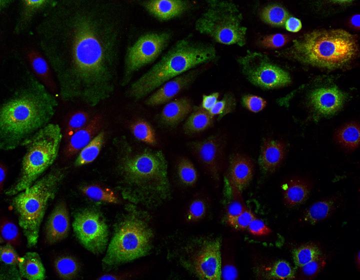 How Viral Infections Linger