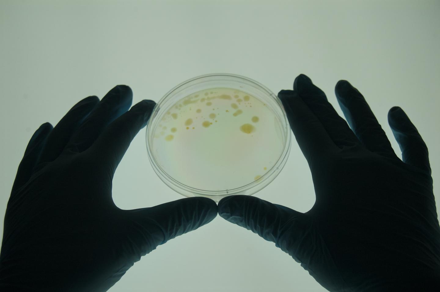 <em>Mycobacterium vaccae</em>