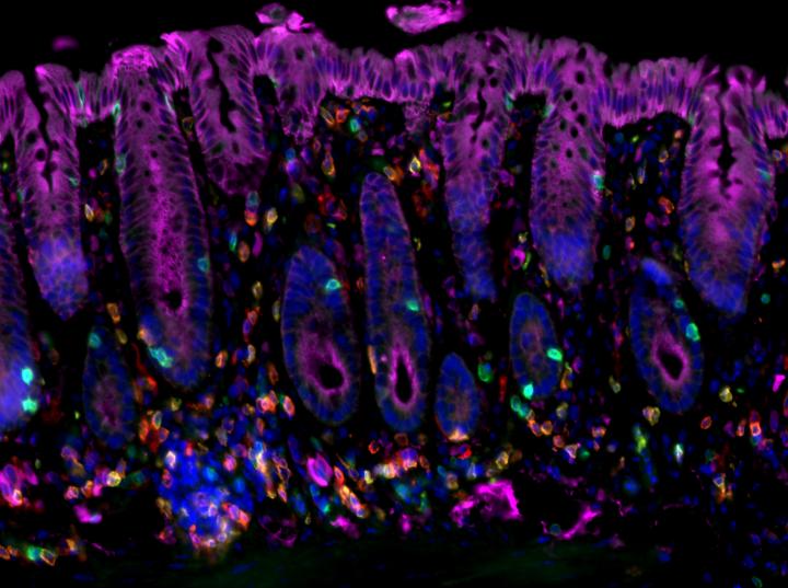 Cancer-Promoting Chronic Inflammation