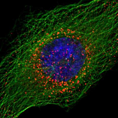 HIV Outside Cell Nucleus
