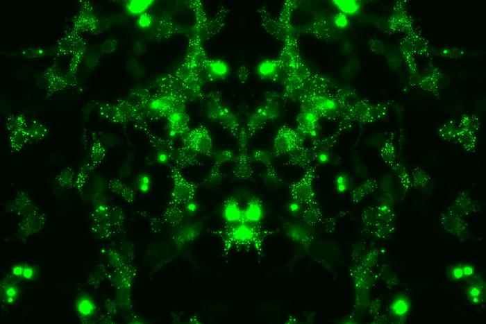 Cells expressing a mutant protein involved in motor neurone disease pathology