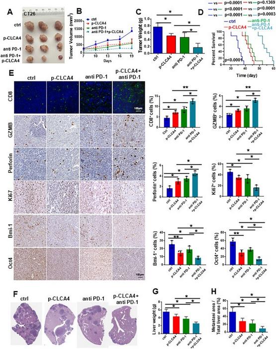 CLCA4 overexpression enhanced the therapeutic effect of anti-PD-1.