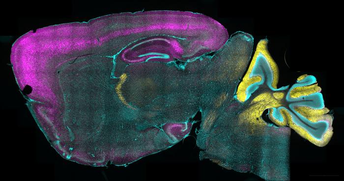 Dravet syndrome mouse brain cross-section