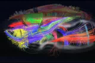 A New Look at How Our Brains Are Organized (3 of 6)