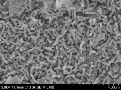 SAR11 Bacteria