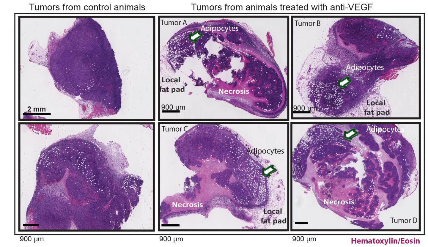 How Obesity Helps Breast Cancer Overcome Anti-Vascular Therapy (1 of 1)