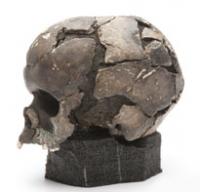 Scanning the Skull