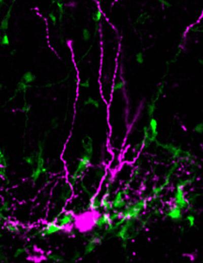 Interneuron