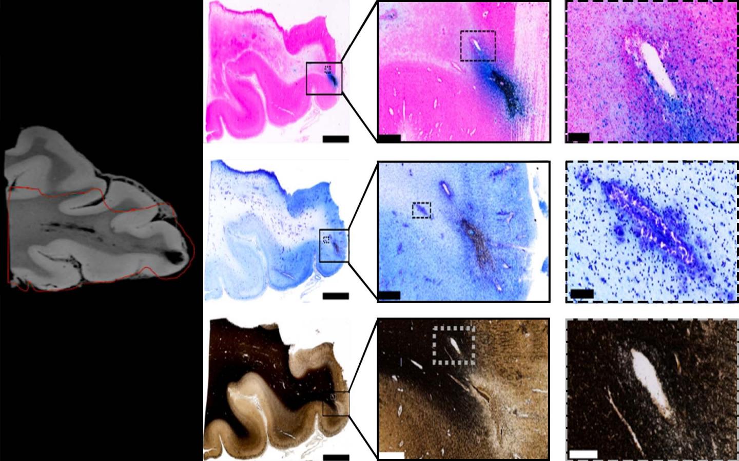 Tissue Imaging