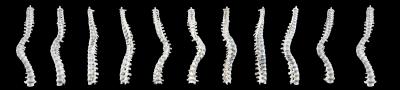 The Complete Skeleton Showing the Curve of the Spine