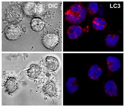 Autophagy