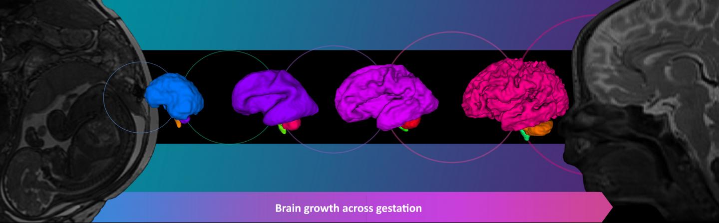 The Developing Brain