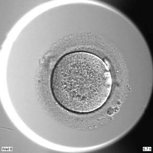 Development of human embryo without NANOG gene