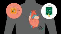 Doctors Successfully Synchronize both Sides of the Heart with Promising New Wirelessly Powered, Lead