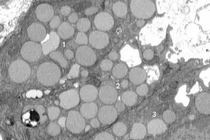 Cells ‘vomit’ waste to promote healing, mouse study reveals