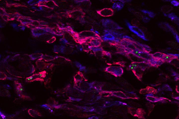 Leishmania in Immune Cells