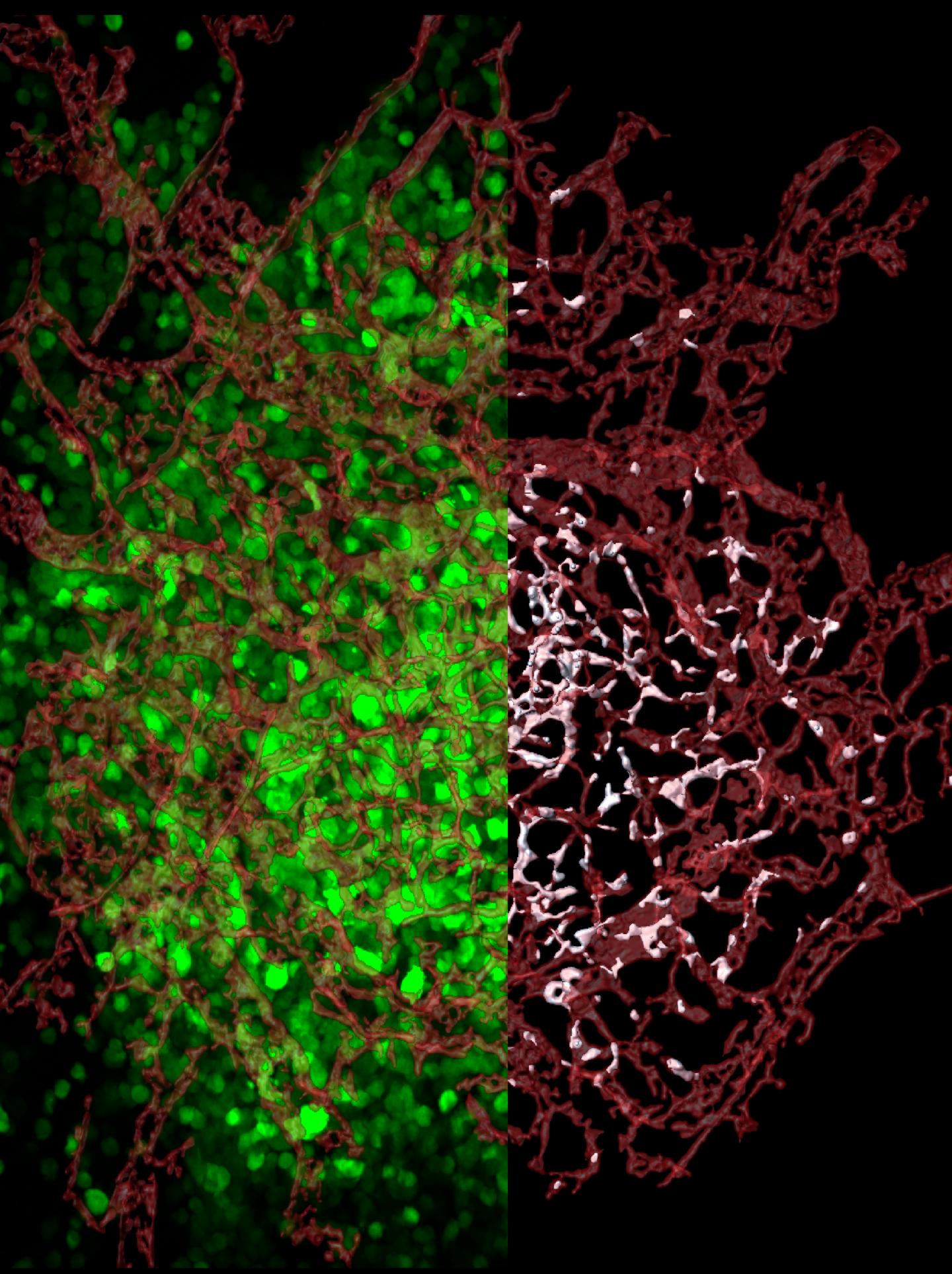 Where Tumor Cells Enter the Bloodstream