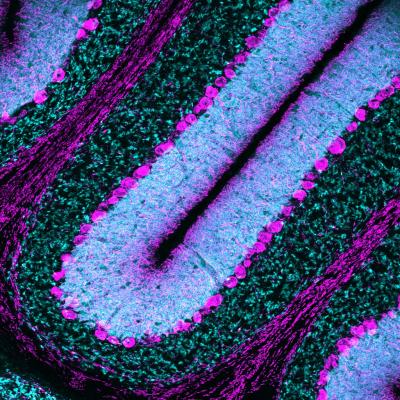 Purkinje cells