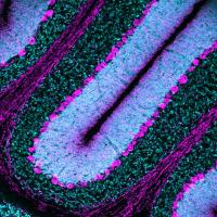 Purkinje cells
