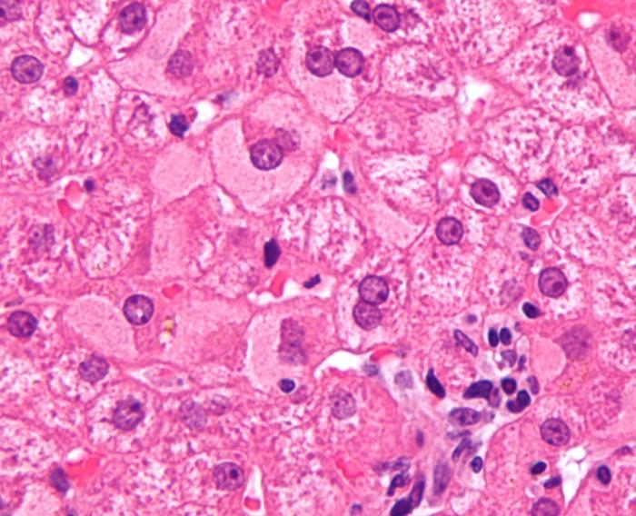 Self-protective mechanism against drug-induced liver injury