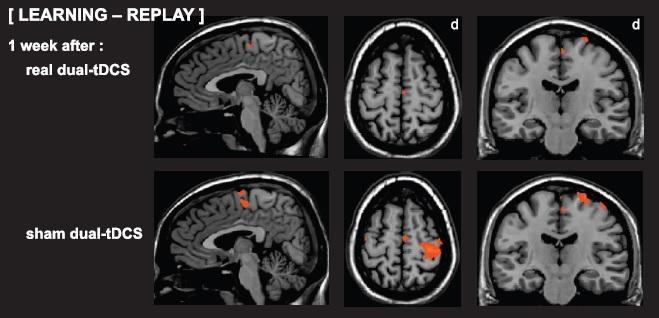 Brain Activity Efficiency